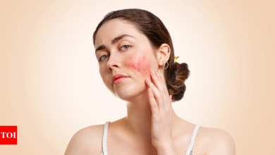 5 reasons you have red patches on your skin