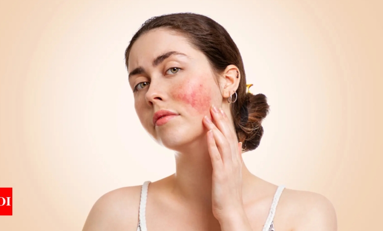 5 reasons you have red patches on your skin