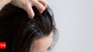 5 easy hacks to remove dandruff from your hair