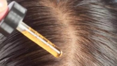 Simple ways to use Castor Oil to grow hair in bald patches