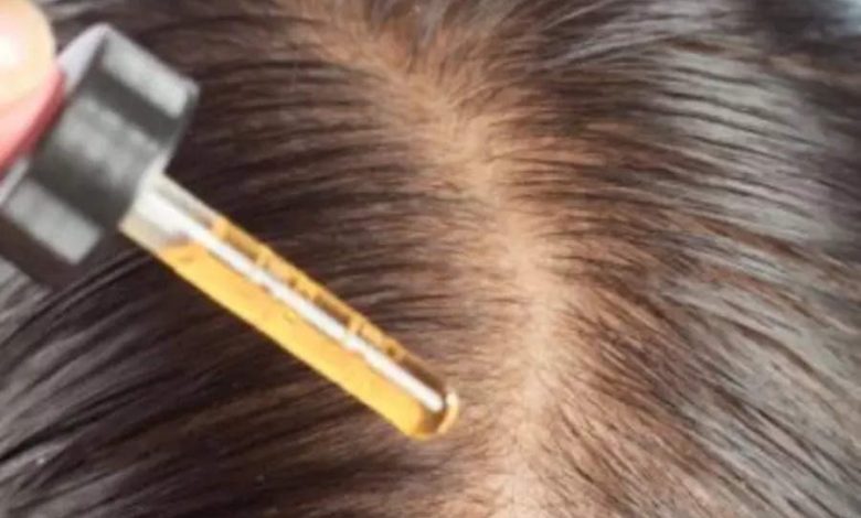 Simple ways to use Castor Oil to grow hair in bald patches