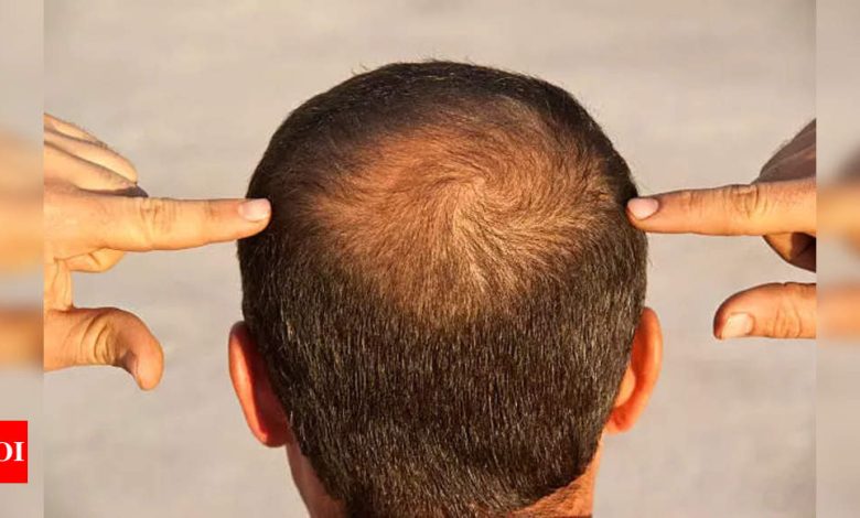 Jojoba oil for hair growth: How to use Jojoba Oil to regrow hair in bald patches |