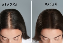 Coconut oil for hair growth: Explained: What is the correct way of massaging Coconut Oil to regrow hair in bald patches? |