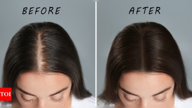 Coconut oil for hair growth: Explained: What is the correct way of massaging Coconut Oil to regrow hair in bald patches? |