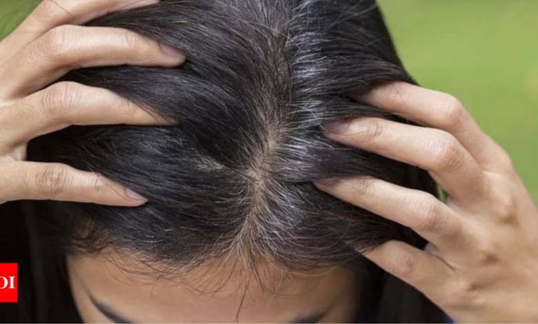 Dark Black Hair: 5 home remedies to try if you want dark black hair |