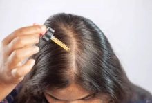 Hair Fall: This is the best way to oil hair if you suffer from severe hair fall |