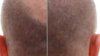 10 easy tips to follow if you want to regrow hair on your scalp