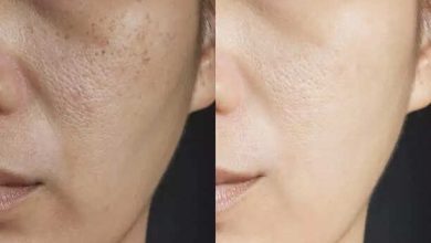 5 foods which are rich in Glutathione and brilliant for your skin