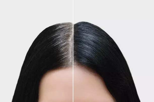 5 foods to eat if you want to delay greying of hair