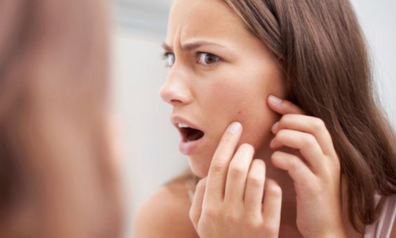 Stop these 5 skincare habits that are making your pores clogged!