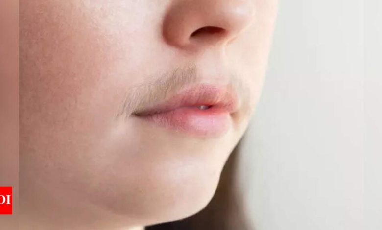 Desi remedies for facial hair Removal: Natural ways to tame unwanted growth |