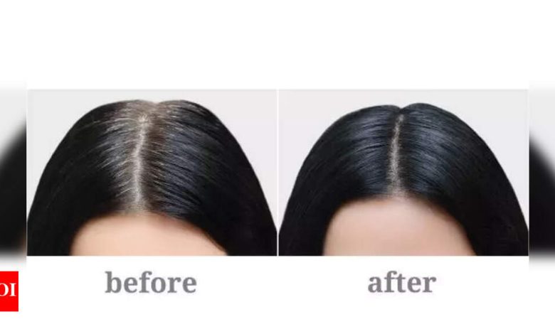 Coffee Hair Dye: How to dye your hair naturally with Coffee |