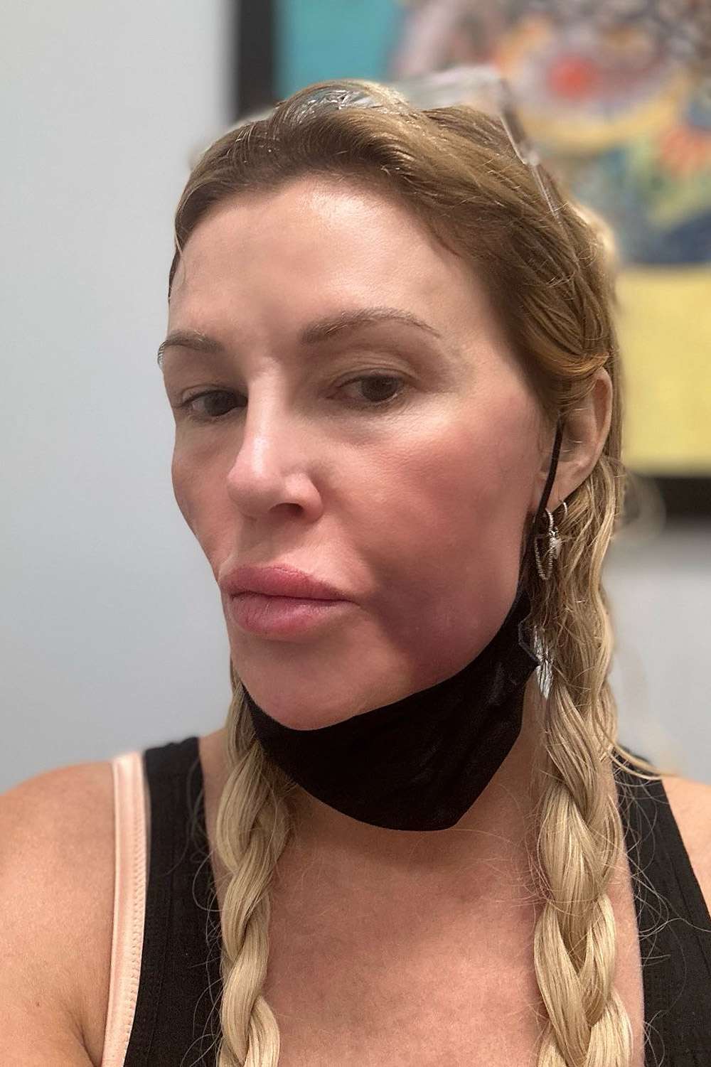 Brandi Glanville Says Shes Been Hiding Out Due to Cruel Comments on My Appearance amid Facial Disfigurement
