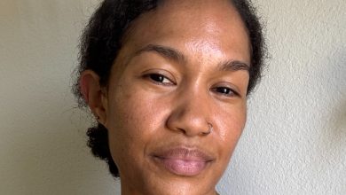 Retinol Irritates My Sensitive, Acne-Prone Skin, so I Tried This Shockingly Good Alternative Instead