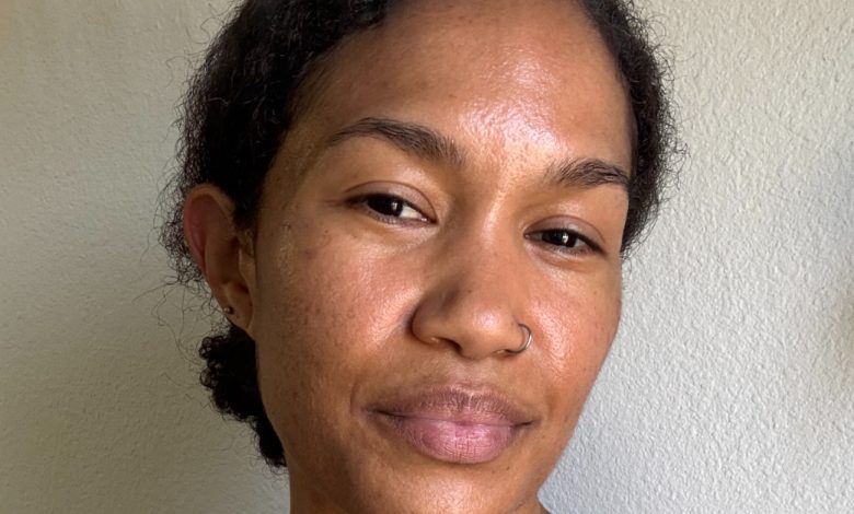 Retinol Irritates My Sensitive, Acne-Prone Skin, so I Tried This Shockingly Good Alternative Instead