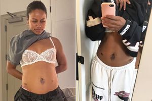 Taylour Paige-Angulo Says Endometriosis Pain