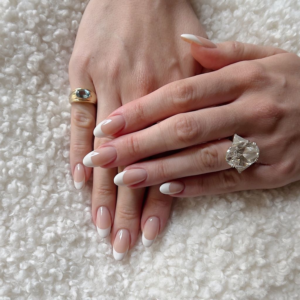 two hands laid flat with diamond ring on one