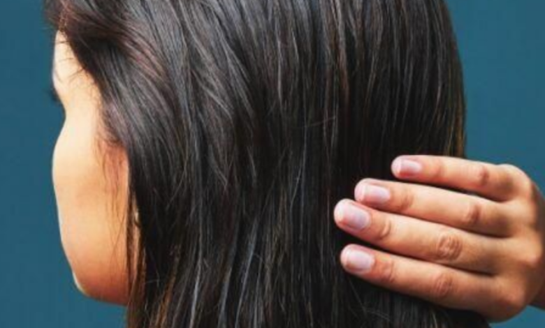 Try these simple home remedies to keep greasy hair at bay during the summer