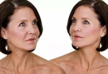 5 habits which will stop the skin of your face from sagging