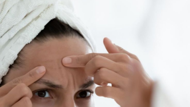 Try these 8 ways to get rid of a pimple in a day