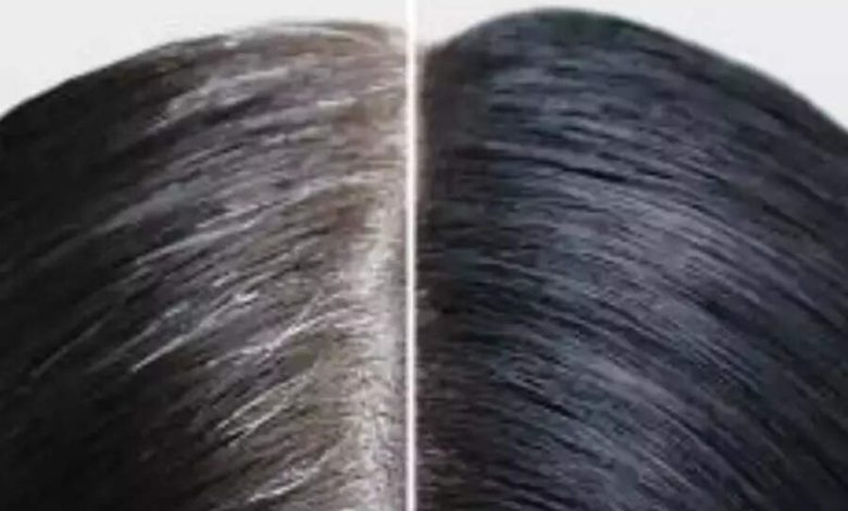 9 daily habits that can delay greying of hair