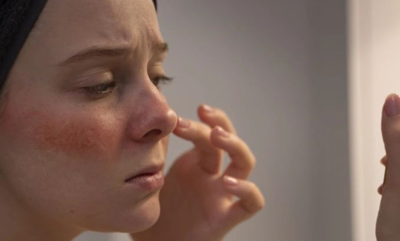 Avoid these 5 ingredients on face if you have a sensitive skin