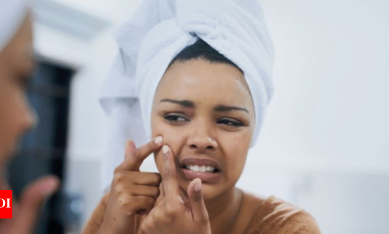 Beat the monsoon breakouts: Skincare tips to keep acne at bay