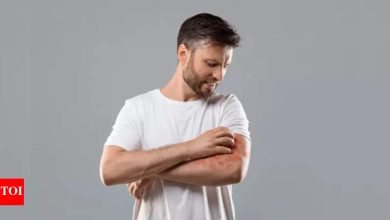 Why fungal acne gets worse during monsoon and what experts say you should do