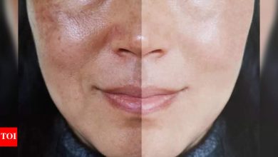 5 face packs to help close those stubborn open pores