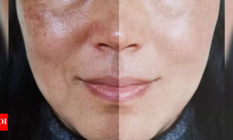 5 face packs to help close those stubborn open pores
