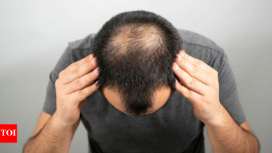 Beat early balding issues with these 4 home remedies