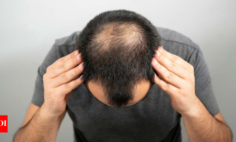 Beat early balding issues with these 4 home remedies
