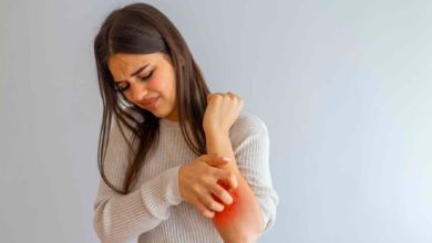 Want to get rid of hives? 9 effective ways to get relief