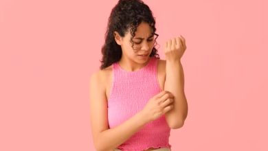 Cucumber to coriander: 10 home remedies for heat rash to soothe your skin