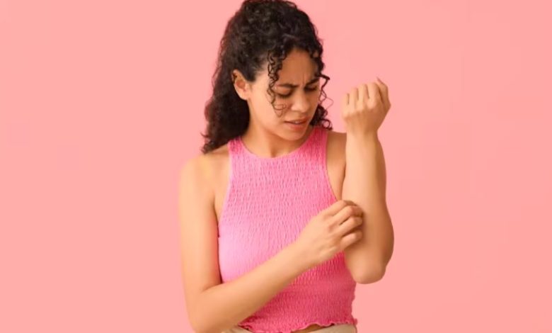 Cucumber to coriander: 10 home remedies for heat rash to soothe your skin