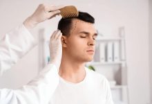 Hair Transplant: A Permanent Solution To Hair Loss