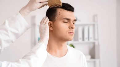 Hair Transplant: A Permanent Solution To Hair Loss