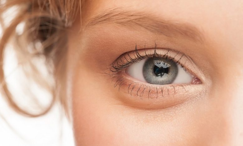 Say Goodbye to Eye Bags: 11 Natural Tricks That Actually Work!