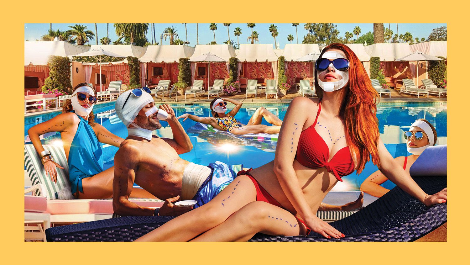 Photo Illustration of people recovering from plastic surgery in a glamorous poolside environment